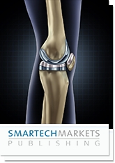【スマーテックマーケッツパブリッシング調査報告】整形外科の付加製造（積層造形）：3D印刷による医療インプラントの市場