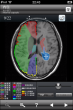 脳血流と大解剖表示