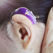 補聴器デコチップ
