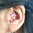 耳穴補聴器デコチップ装着6