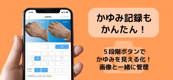 【11月12日はいい皮膚の日】日本初の“アトピー見える化アプリ”に「かゆみ記録機能」を追加！～元アトピーのパパが開発した無料iPhoneアプリ「アトピヨ」~