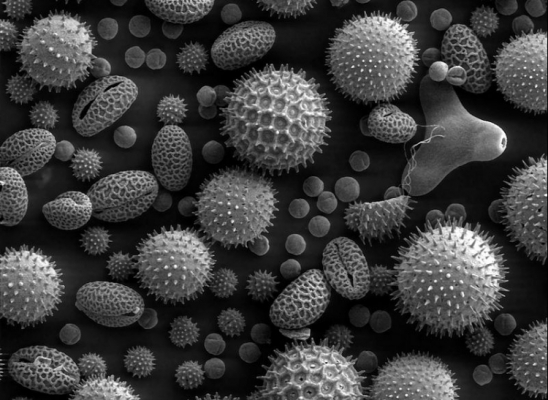 もう悩まない！花粉症対策は腸内環境から。善玉菌とアレルギーの関係を知る事で自分に合った対策を。