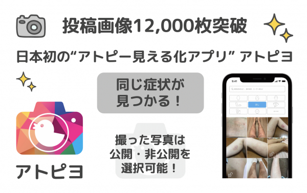 日本初の“アトピー見える化アプリ”の投稿画像が12,000枚突破！ 元アトピーのパパが開発した無料iPhoneアプリ「アトピヨ」