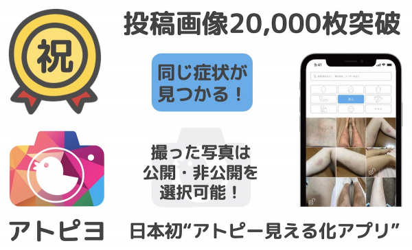 日本初の“アトピー見える化アプリ”の投稿画像が20,000枚突破！ 元アトピーのパパが開発した無料iPhoneアプリ「アトピヨ」 ~投稿画像20,000枚のうち、9,000枚はアプリ内で公開中~